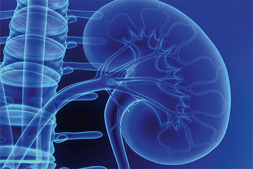 Acute Kidney injury.jpg