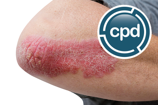 psoriasis summary.jpg