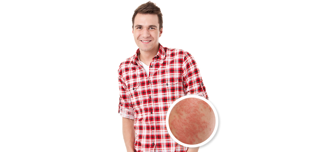 skin condition_s.jpg